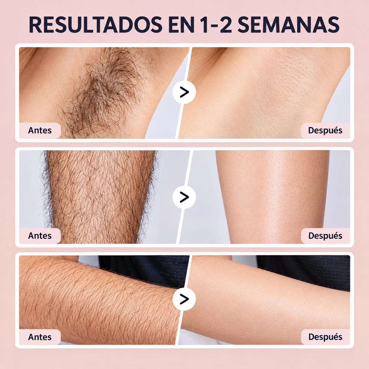 CYPERUS 60ML™ Original ¿Cansada de depilarte y que el vello vuelva a crecer?